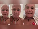 Cantor Netinho, do hit "Milla", completa quarta etapa de quimioterapia