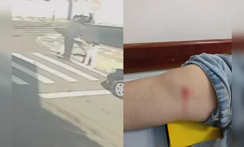 Adolescente é atingida no joelho por bala perdida ao atravessar a rua