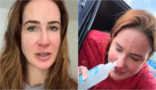 Christine Connell culpa peido de ex-namorado após contrair infecção rara no nariz