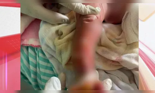 Recém-nascida é internada na UTI após banho em maternidade