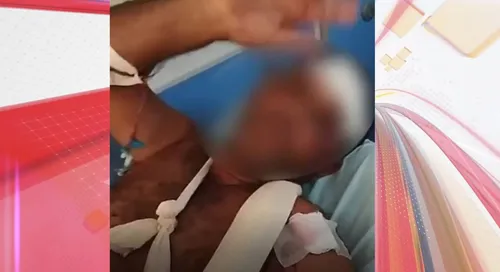 Homem sofreu vários cortes nos braços, ombro, rosto e outras partes do corpo
