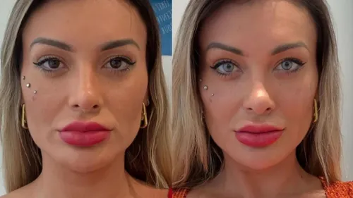Influenciadora reclamou que está sentindo dor e admitiu estar arrependida