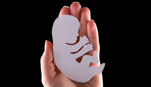No texto do projeto de lei, os autores citam como justificativas as consequências para a saúde física e mental de quem faz aborto.