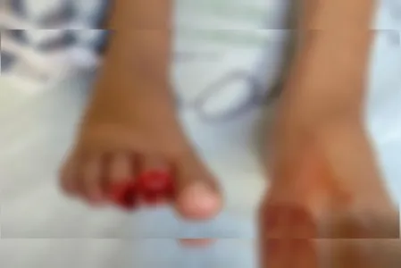 Teria sentido uma dor muito intensa