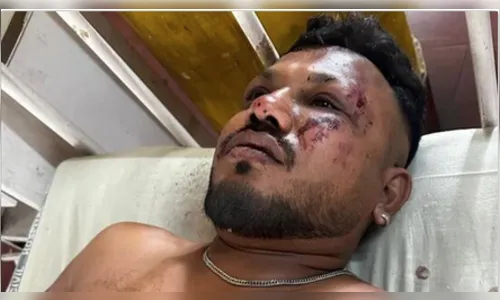 Tragédia aérea com mais de 200 mortes tem um sobrevivente confirmado