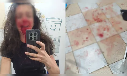 Criminoso espanca mãe que amamentava bebê em loja durante roubo