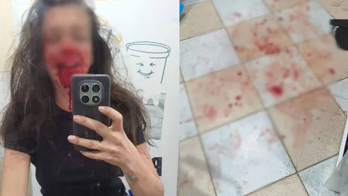 Vítima fez uma foto para registrar os ferimentos após ser espancada