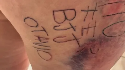 Homem é preso suspeito de torturar e tatuar a companheira à força