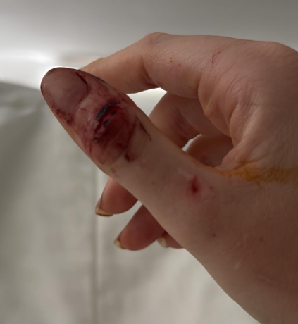 Ex de Dado Dolabella expõe fotos e acusa ator de agressões; veja