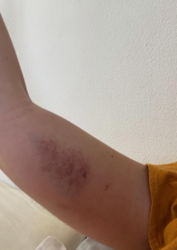 Ex de Dado Dolabella expõe fotos e acusa ator de agressões; veja