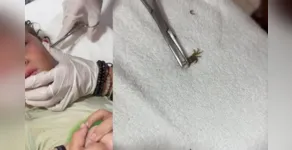  Instantes depois, o caranguejo é visto caminhando sobre a maca 
