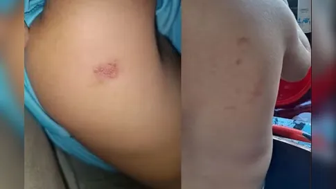 Mãe coloca gravador na mochila de filho e professora é afastada por maus-tratos