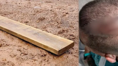 Homem leva paulada na cabeça após tentar enforcar ex por causa de celular