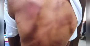 CHOCANTE
