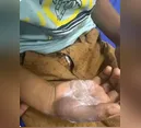 Mãe é presa em Goiás suspeita de queimar o próprio filho com colher quente após castigo