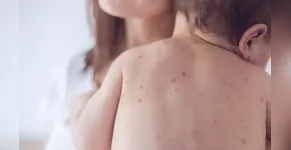 Saúde