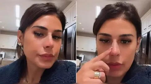 Alvo de comentários negativos, novo nariz de Simone Mendes ganha defesa de Gretchen