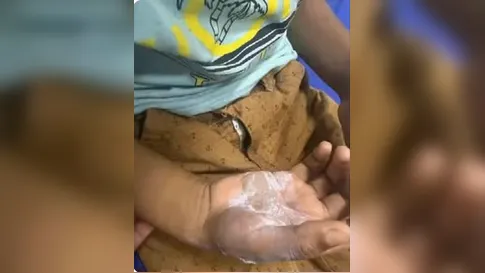 Mãe é presa em Goiás suspeita de queimar o próprio filho com colher quente após castigo