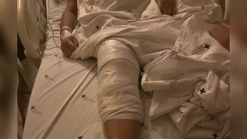 Idosa passa por cirurgia e ao acordar percebe que médicos implantaram prótese em joelho errado no PR