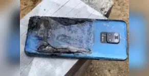  Homem teve que rasgar a calça para evitar mais danos e retirar o celular do bolso. 