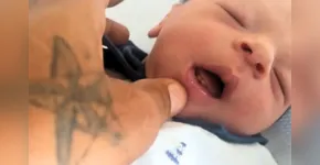  Itallo nasceu com dois dentes 
