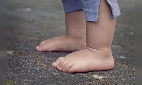 Bebê de 10 meses fica em estado grave após ser atropelado pelo pai