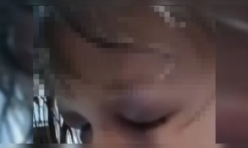 Menina de 03 anos é espancada pelo padrasto e tem traumatismo craniano