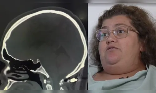 Mulher atingida por bala perdida deixa hospital no PR; projétil ficou a 4 mm da medula cervical