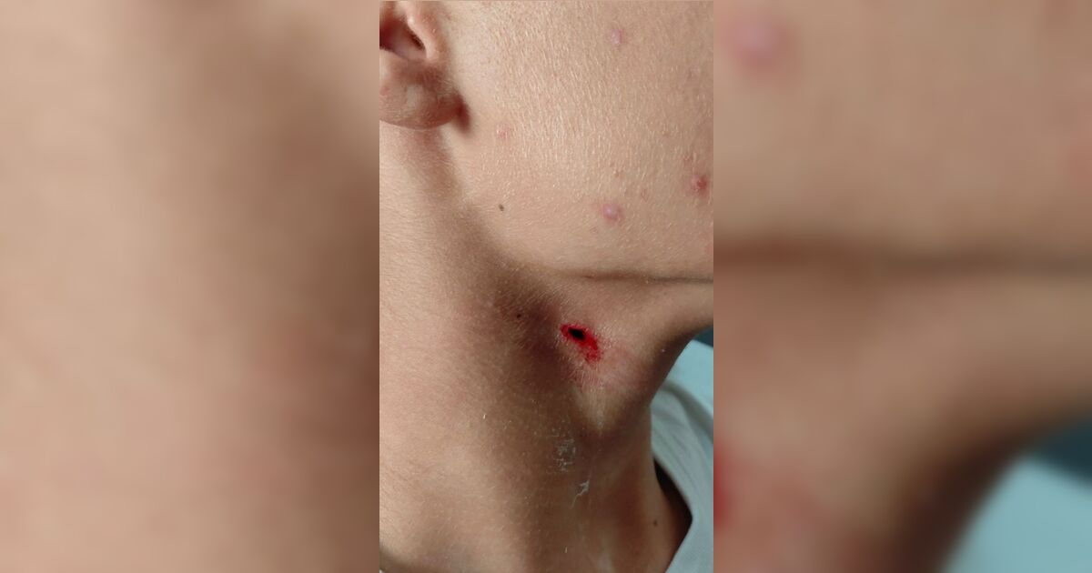 Aluno de 15 anos ataca colega com caneta no pescoço dentro de colégio no PR
