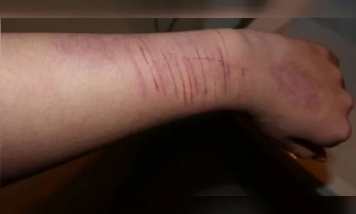 Um em cada três adolescentes relata 'vontade de se machucar de propósito', aponta pesquisa