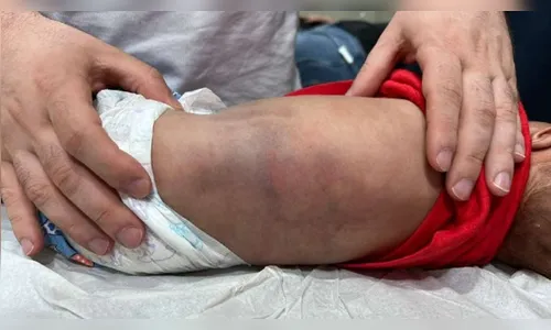 Homem é condenado a 22 anos de prisão por espancar filho de três meses no PR