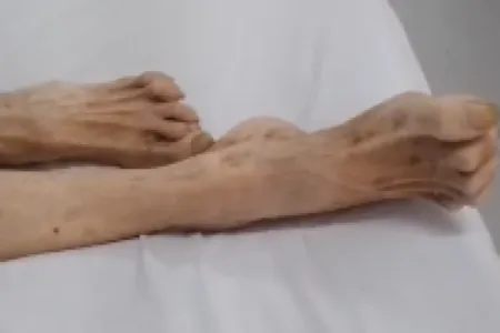Idosa foi abandonada por filho advogado em unidade de saúde, em Goiânia