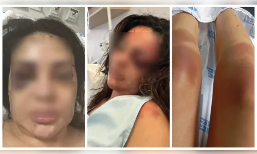 Médica de Maringá que foi espancada faz relato emocionante; assista