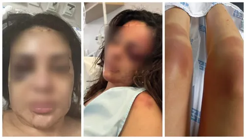 Laíze relatou que, após ser agredida, permaneceu desacordada por cerca de 12 horas até ser encontrada por suas amigas
