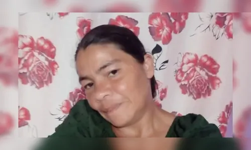 Mulher morre em hospital de PG após sofrer graves queimaduras