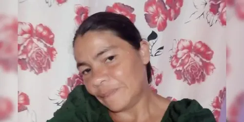 Mulher morre em hospital de PG após sofrer graves queimaduras