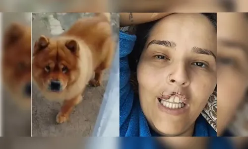 Marido manda matar cachorro que arrancou lábio de mulher