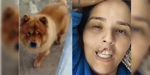 Cachorro arrancou parte do lábio da tutora