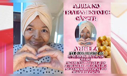 Filha faz promoção de pão de queijo para ajudar mãe com câncer