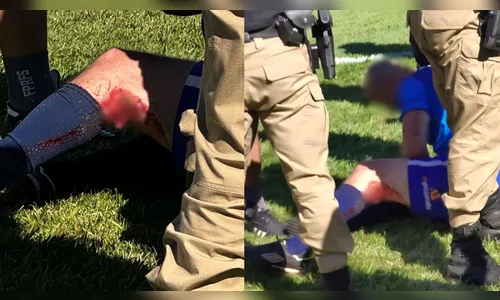 Jogador fica ferido com “bala de borracha” durante torneio em Arapongas (PR)