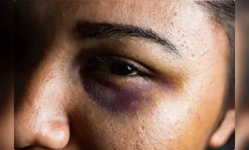 Homem agride ex, tenta fugir da PM e acaba preso em Bom Sucesso