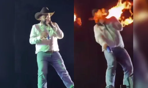 Léo, da dupla com Raphael, é atingido por fogo no rosto durante show