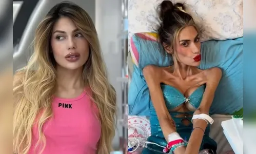 Morre influencer de 30 anos que pesava 22 kg