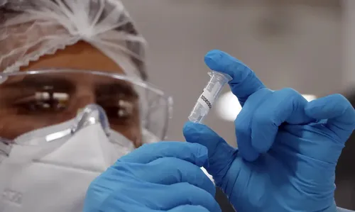 O chefe da 16ª Regional de Saúde, Lucas Leugi, aponta que a população precisa se prevenir através da vacinação contra a gripe (influenza).
