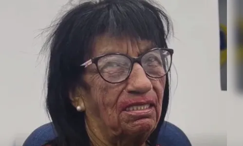 Mulher procura namorado na rádio, mas desanima ao ver o pretendente