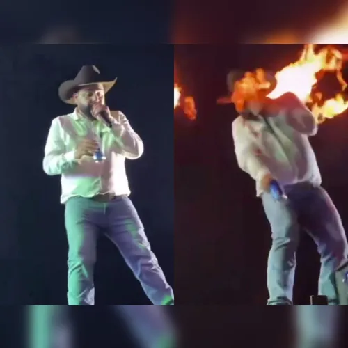 Léo, da dupla com Raphael, é atingido por fogo no rosto durante show