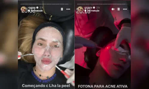 
							Virginia mostra cicatrizes e faz tratamento com esperma de salmão
						
						