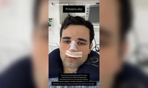 
							Ex-BBB Matteus Amaral mostra como ficou seu nariz após plástica; veja
						
						