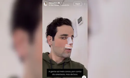 
							Ex-BBB Matteus Amaral mostra como ficou seu nariz após plástica; veja
						
						