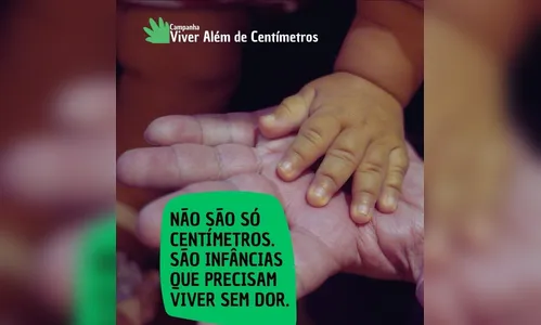 
							Annabra reforça inclusão e direitos de crianças com nanismo no país
						
						